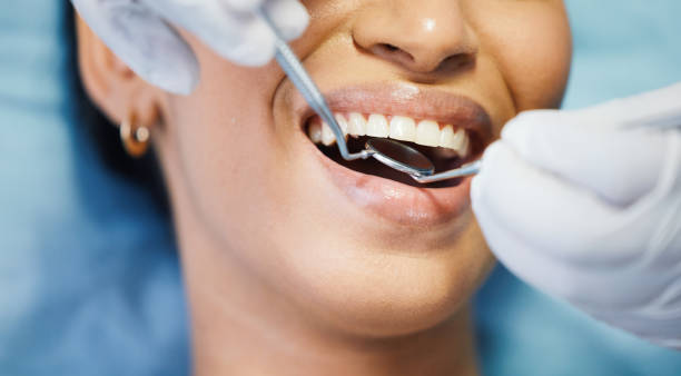 Best Emergency Dental Care for Sports Injuries in Cascades, VA