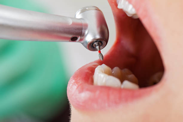 Best Emergency Care for Gum Disease in Cascades, VA